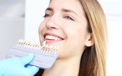 The Art of Smile Enhancement: All About Dental Veneers